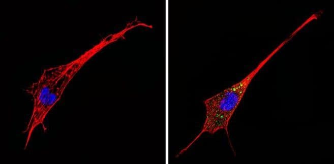 Alpha 1 adrenergic receptor (A1AR) autoantibody