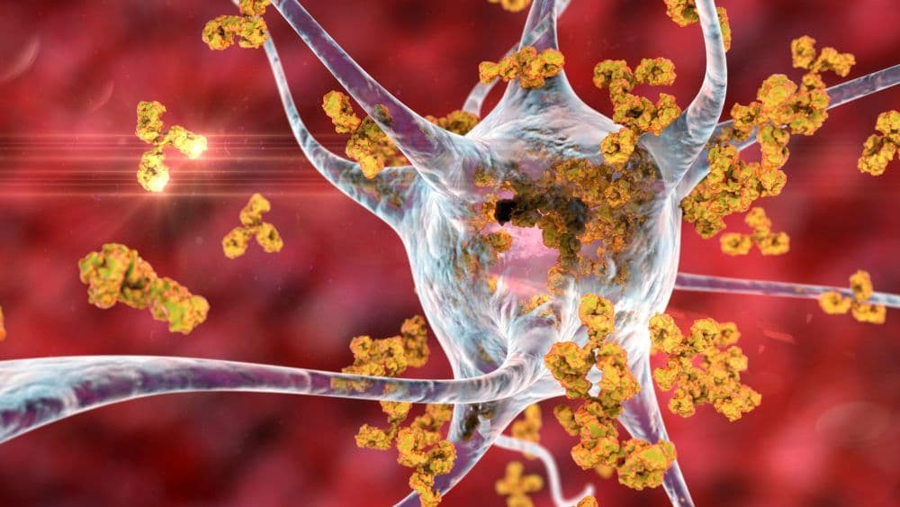 Autoimmunity and Immune Dysregulation in Long COVID